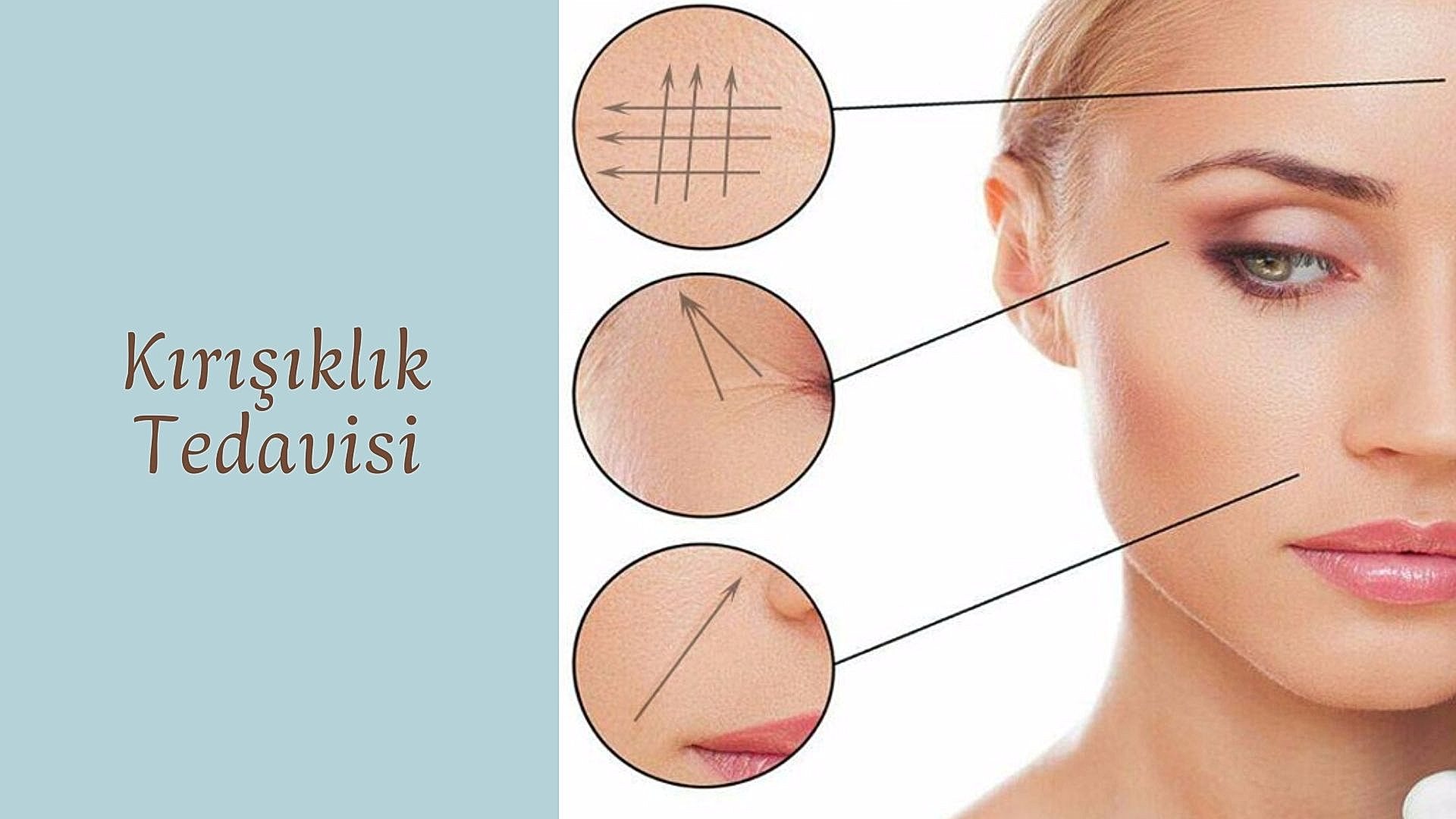 ankara kirisiklik tedavisi