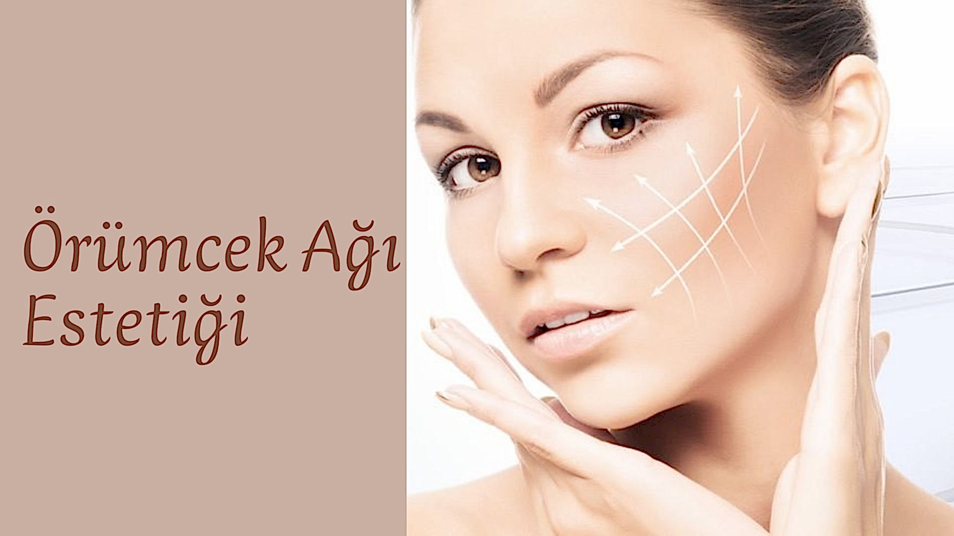 ankara orumcek agi estetigi