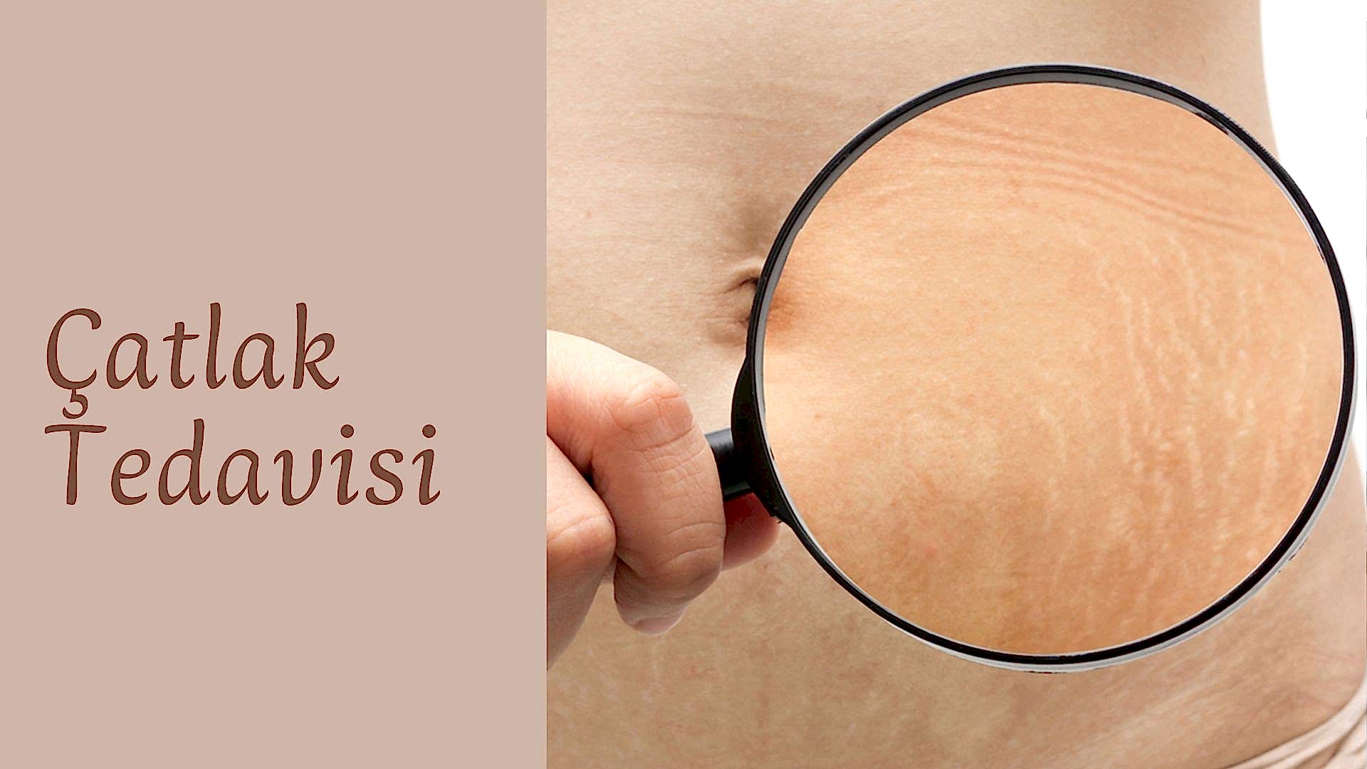 ankara-catlak-tedavisi