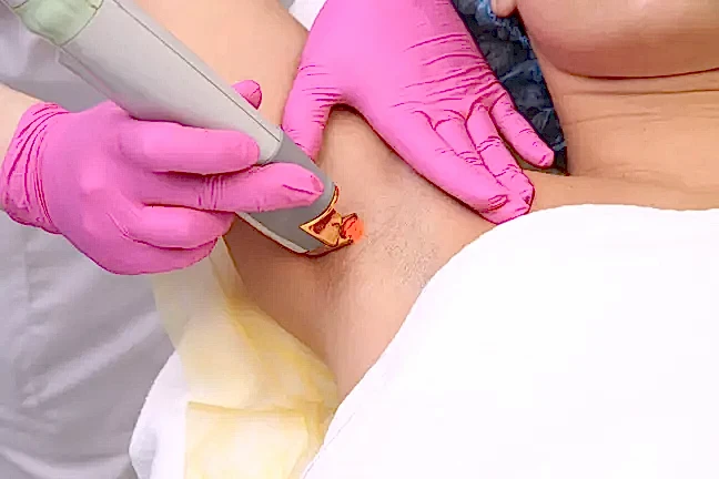 lazerden-sonra-yapilmamasi-gerekenler