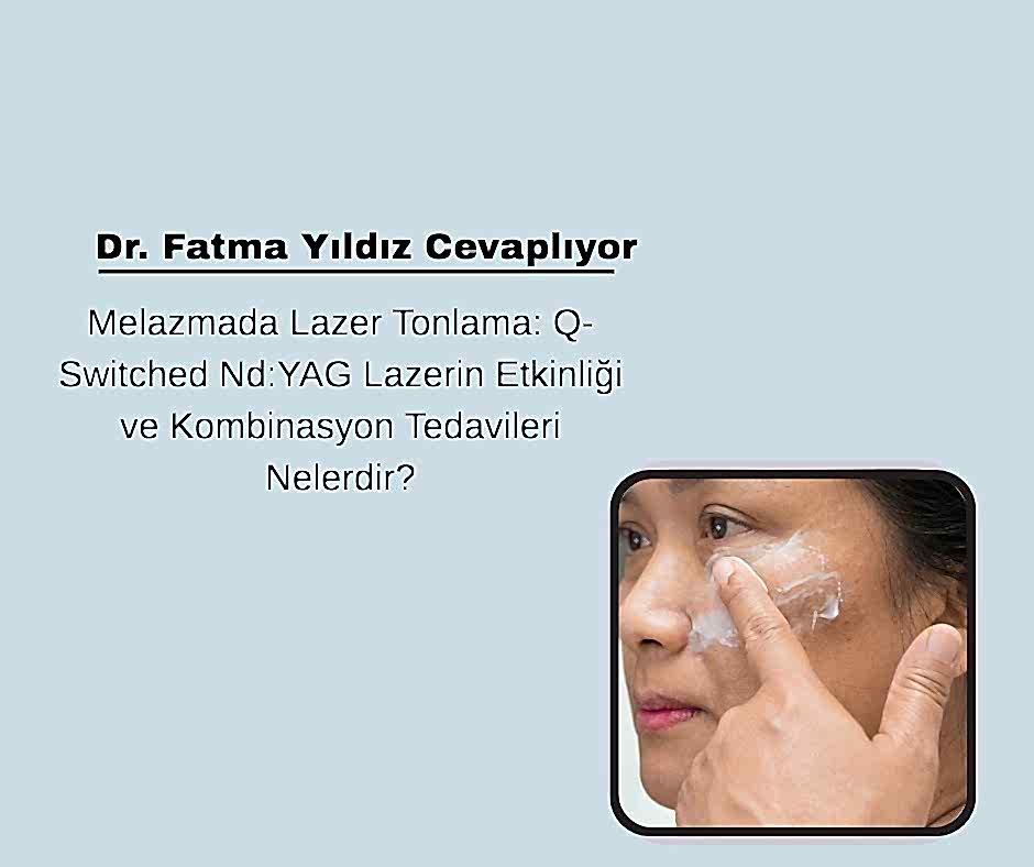 Melazmada Lazer Tonlama: Q-Switched Nd:YAG Lazerin Etkinliği ve Kombinasyon Tedavileri Nelerdir?