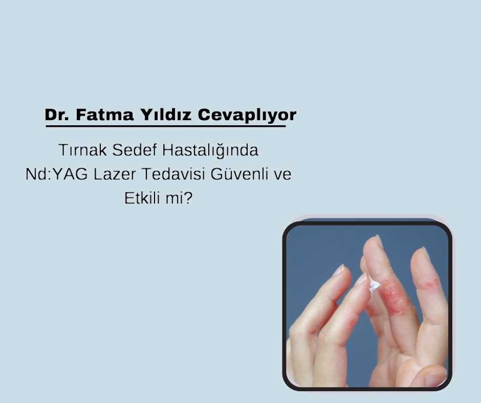 Tırnak Sedef Hastalığında Nd:YAG Lazer Tedavisi Güvenli ve Etkili mi?