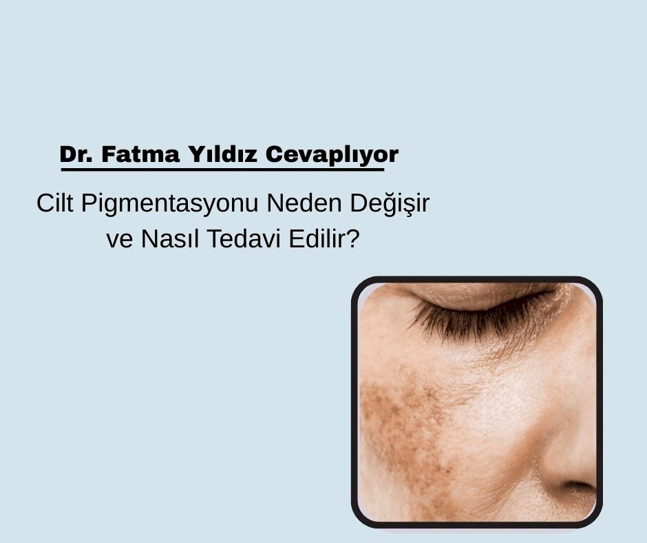 Cilt Pigmentasyonu Neden Değişir ve Nasıl Tedavi Edilir?