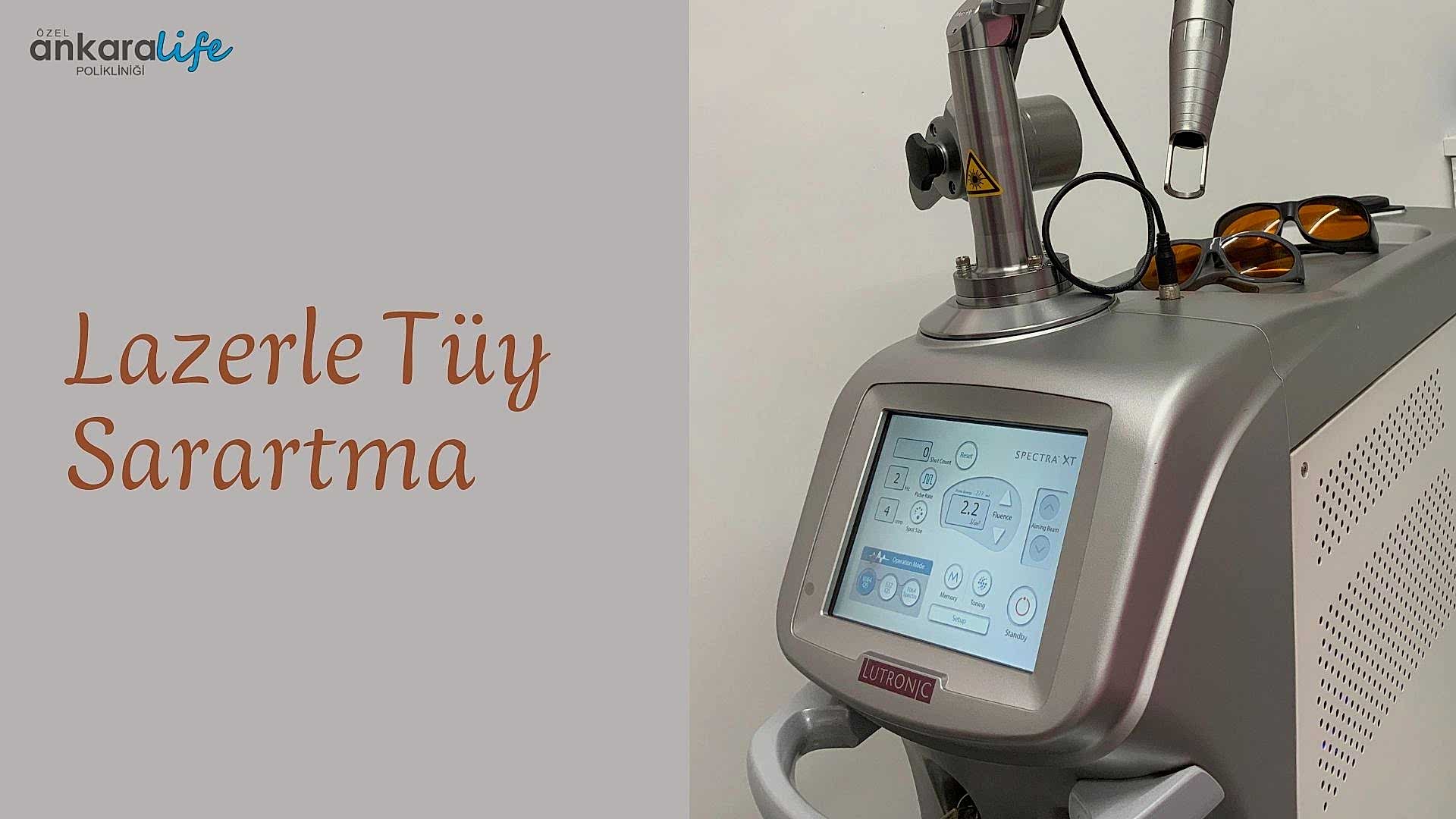 ankara-lazerle-tuy-sarartma