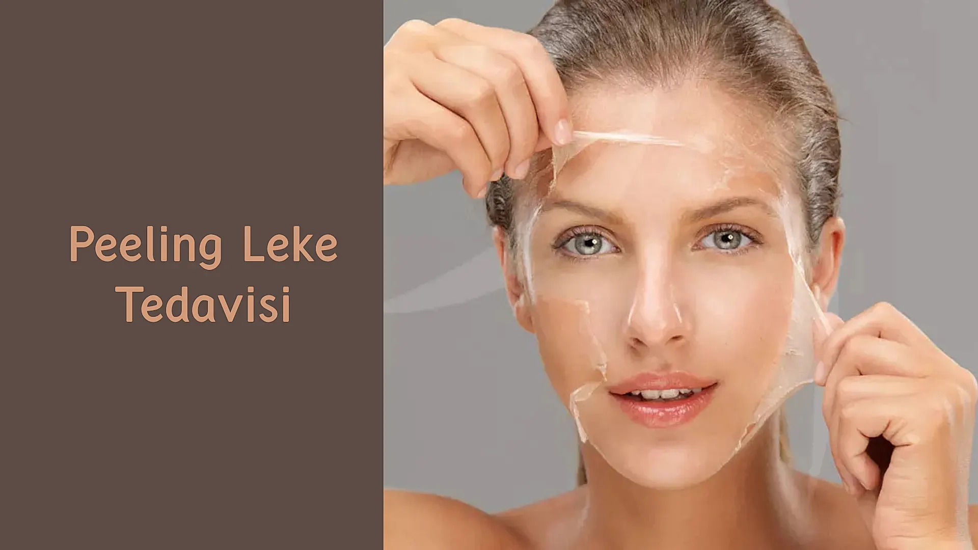 peeling leke tedavisi