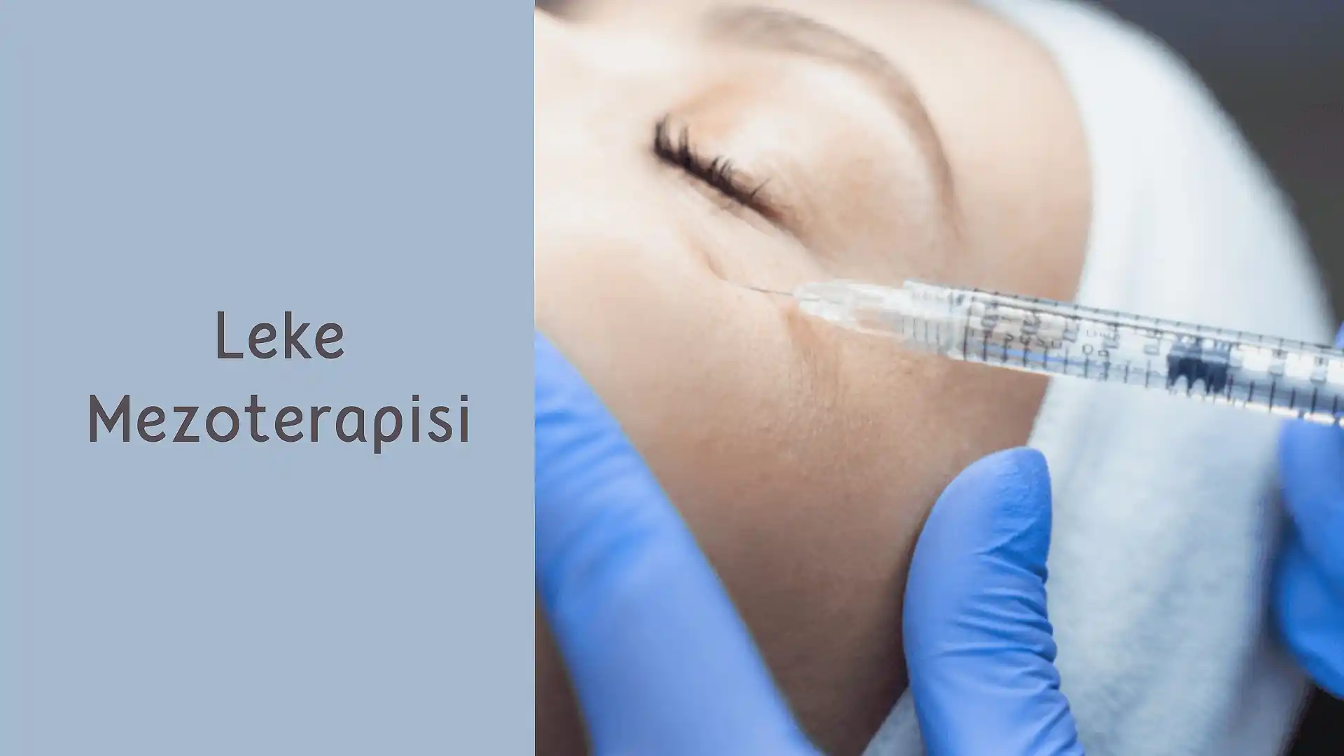 leke mezoterapisi