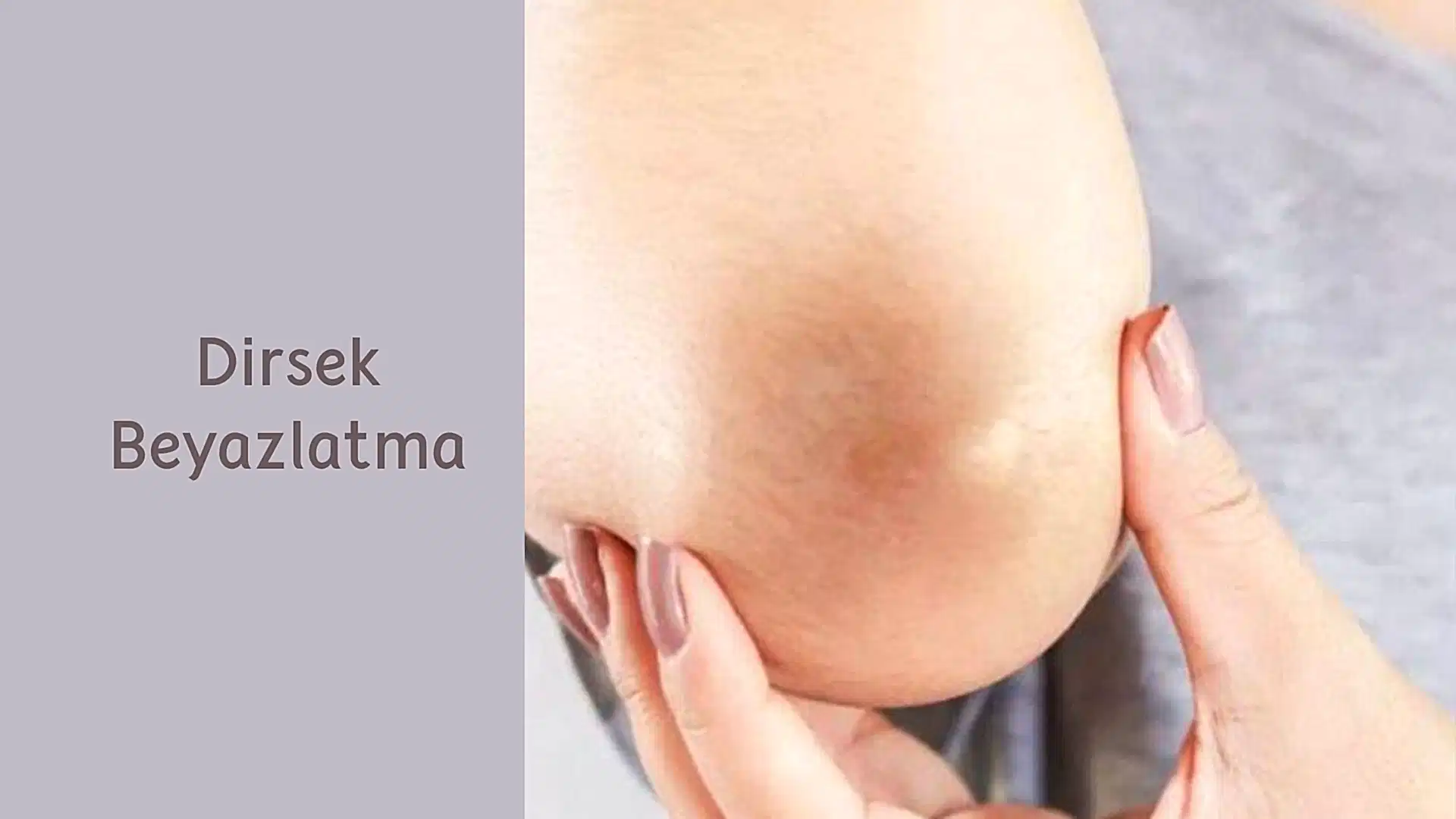 ankara dirsek beyazlatma