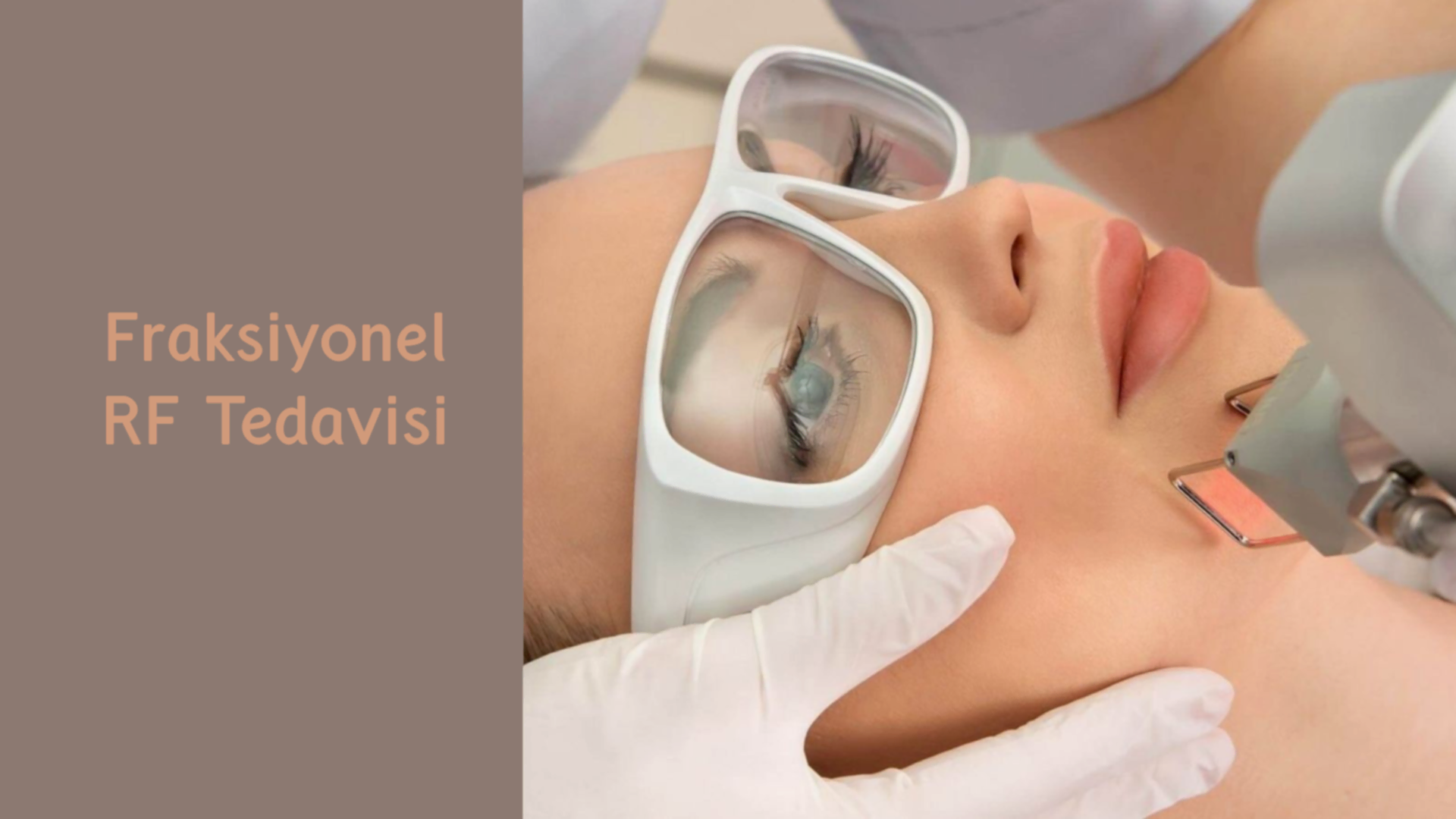 ankara fraksiyonel rf tedavisi