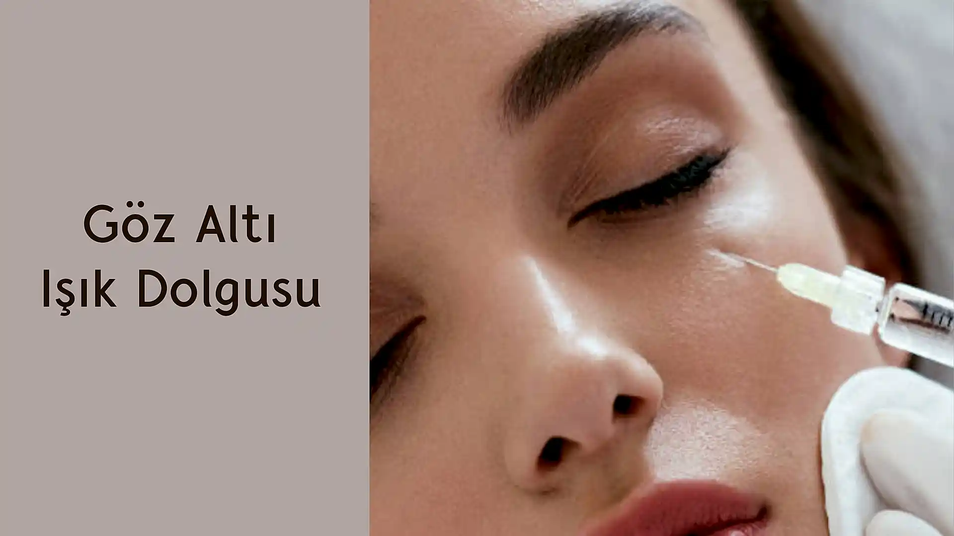 ankara goz alti isik dolgusu