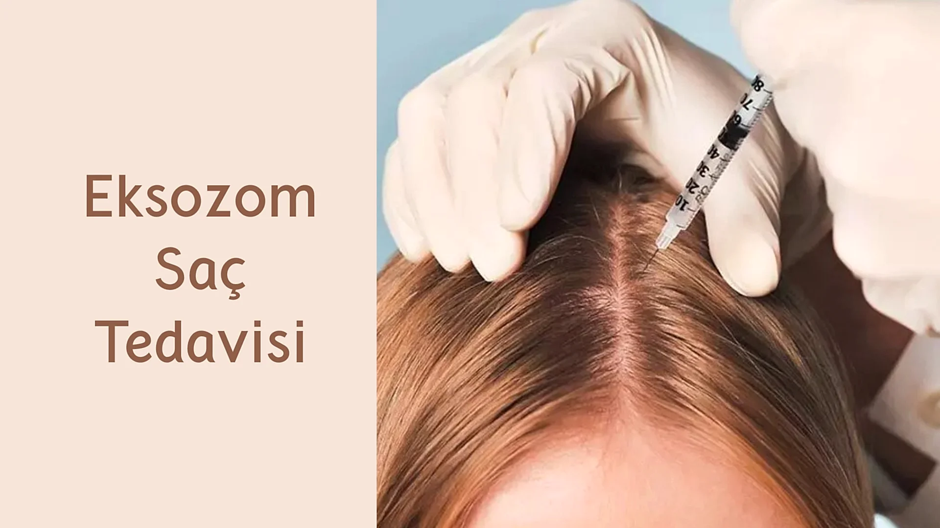 ankara eksozom sac tedavisi